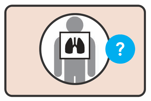 CXR screening